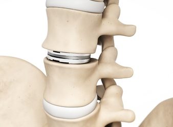 Medical Devices Rules, 2017